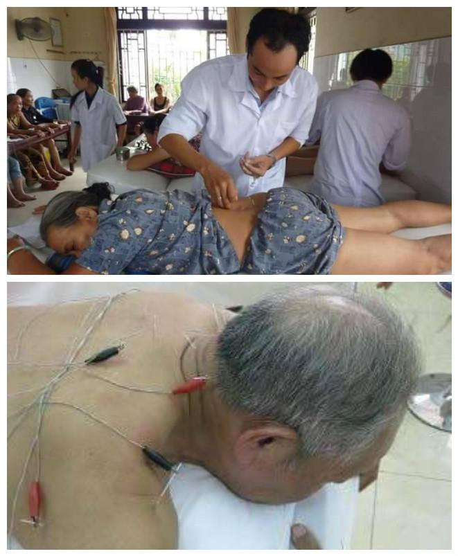 C:\Users\Hai\Desktop\triệu đức hòa\hoạt động\châm cứu.jpg